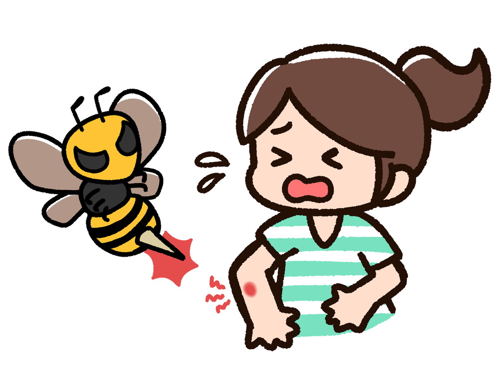 服装以外の注意点
